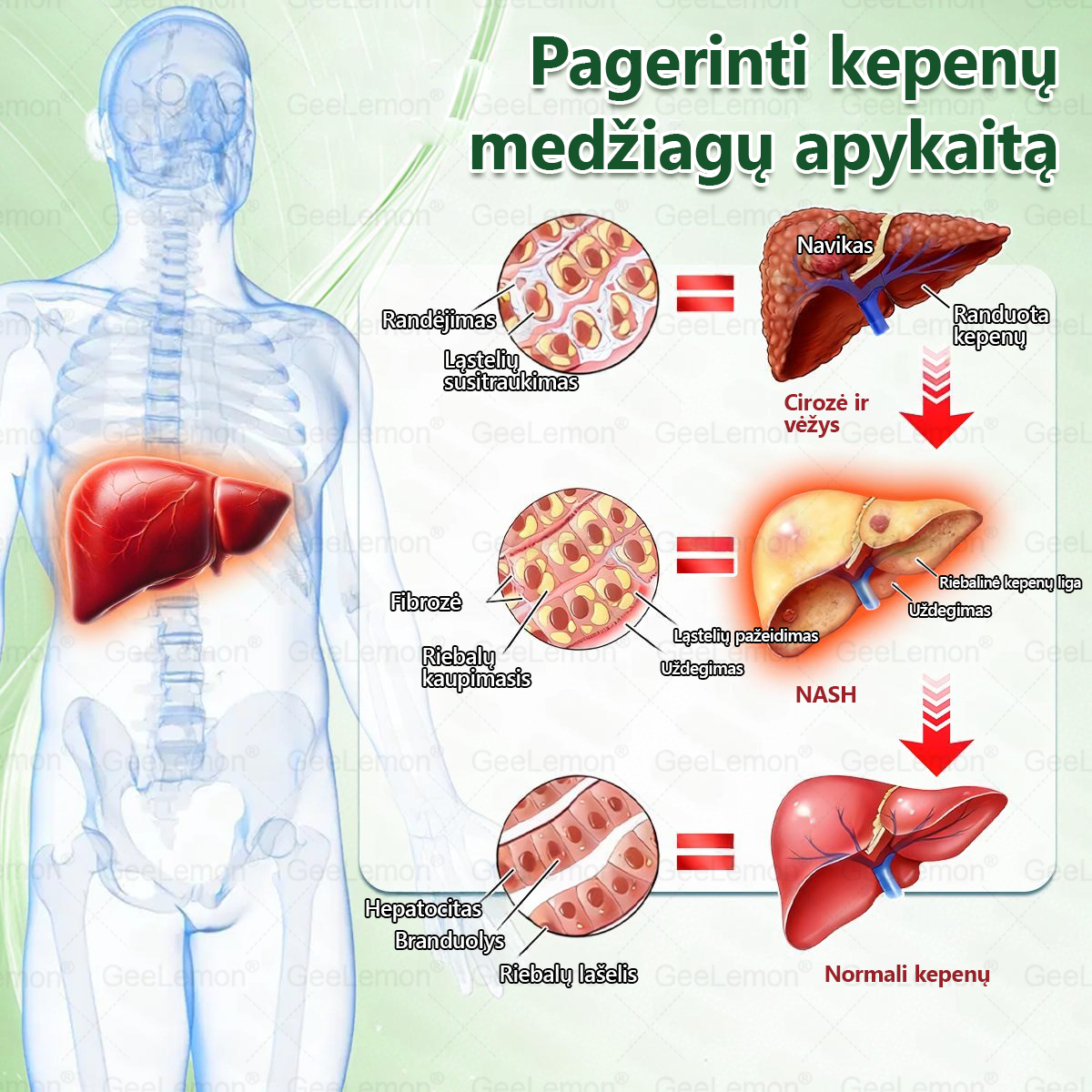 🎁 Liko tik 5 dėžutės! Tik dabar suteikiame papildomą 30% nuolaidą – puiki proga pasirūpinti savimi už mažesnę kainą.