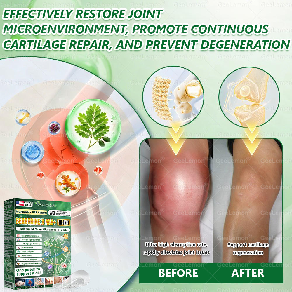𝐎𝐟𝐟𝐢𝐜𝐢𝐚𝐥 𝐍𝐙 𝐒𝐭𝐨𝐫𝐞 🇳🇿 | 🧑‍⚕️🩺 𝐆𝐞𝐞𝐋𝐞𝐦𝐨𝐧® Moringa · Berberine × NAD+ 𝟏𝟎-𝐢𝐧-𝟏 𝐀𝐝𝐯𝐚𝐧𝐜𝐞𝐝 𝐍𝐚𝐧𝐨 𝐌𝐢𝐜𝐫𝐨𝐧𝐞𝐞𝐝𝐥𝐞 𝐏𝐚𝐭𝐜𝐡 — 𝐎𝐧𝐜𝐞 𝐃𝐚𝐢𝐥𝐲, 𝐕𝐢𝐬𝐢𝐛𝐥𝐞 𝐑𝐞𝐬𝐮𝐥𝐭𝐬 𝐢𝐧 𝟕 𝐃𝐚𝐲𝐬
