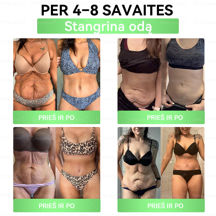 🎁 Liko tik 5 dėžutės! Tik dabar suteikiame papildomą 30% nuolaidą – puiki proga pasirūpinti savimi už mažesnę kainą.