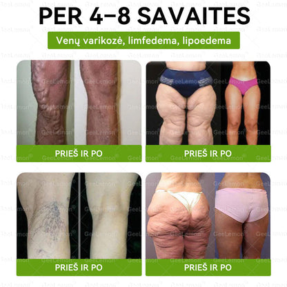 🎁 Liko tik 5 dėžutės! Tik dabar suteikiame papildomą 30% nuolaidą – puiki proga pasirūpinti savimi už mažesnę kainą.